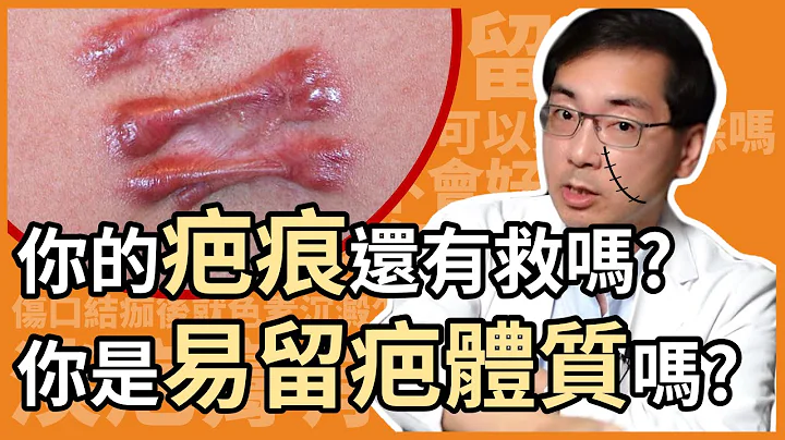 受伤后的疤痕分哪几种？你的疤痕还有救吗？你是易留疤的体质吗？ - 天天要闻