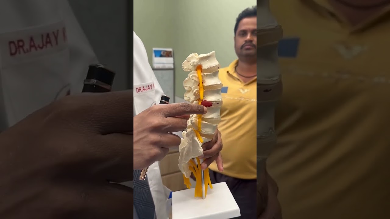 How is the pain in Lumbar spine Slip disc #neuroscience #spine #endoscopy #roboticspinesurgery