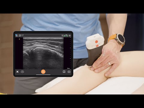 Image of Medial Knee Ultrasound