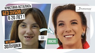 Кристина осталась БЕЗ ЗУБОВ в 20 лет! → Дантистофф #зубныепротезы #имплантациязубов