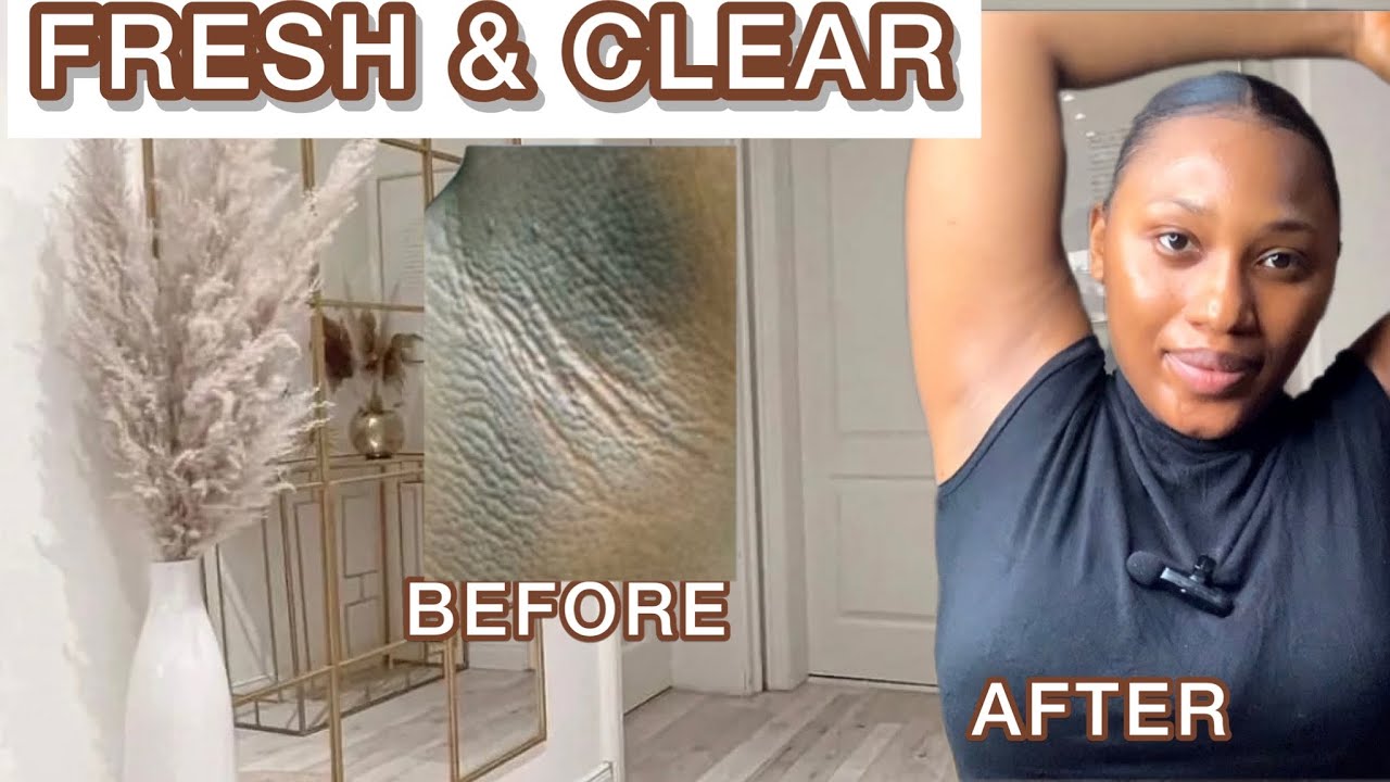 how-to-brighteni-dark-armpit-get-rid-of-dark-armpit-no-odor