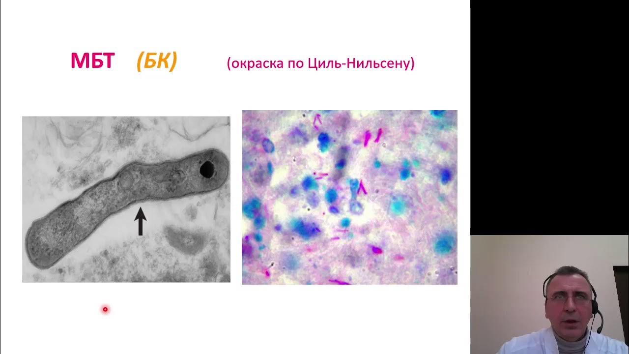 Туберкулез видеоролик