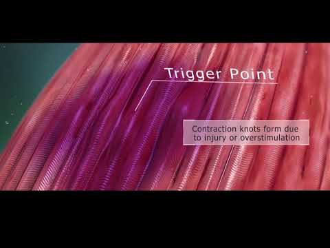Video: Magnetotherapie - Contra-indicaties, Indicaties, Beoordelingen