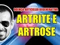 Artrite e Artrose - Doença Articular Degenerativa - Anatomia Humana - Articulações - VideoAula 085