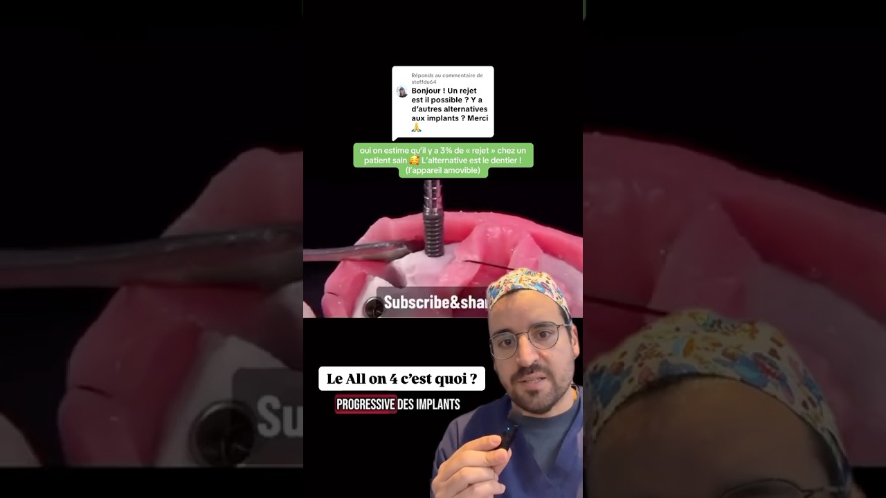 All-on-4 : Une solution implantaire et en une seule intervention ?