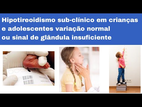 Vídeo: Hipotireoidismo Em Crianças - Hipotireoidismo Congênito Subclínico Em Crianças