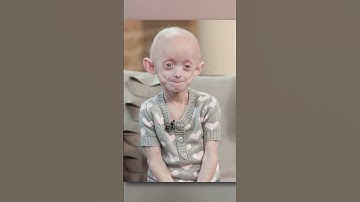 Do You Have Any Unique Body Feature