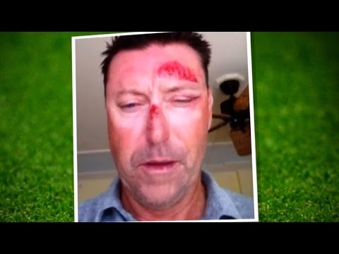 Video: Robert Allenby Čistá hodnota: Wiki, ženatý, rodina, svatba, plat, sourozenci