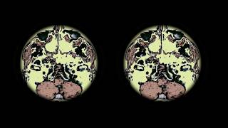 Download lagu Pegg -  Lenticular Clouds