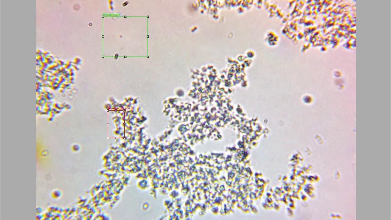 дрожжевые грибки saccharomyces boulardii. молоко под микроскопии. кефирный грибок под микроскопом. кефир под микроскопом. молочнокислые бактерии в молоке под микроскопом.