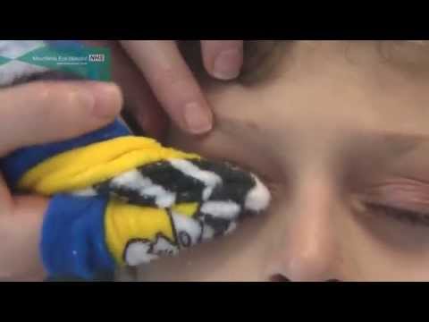 Come pulire i bordi delle palpebre nei bambini e nei neonati