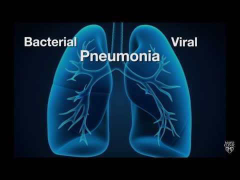 Video: What Is The Difference Between Pneumonia And Pneumonia