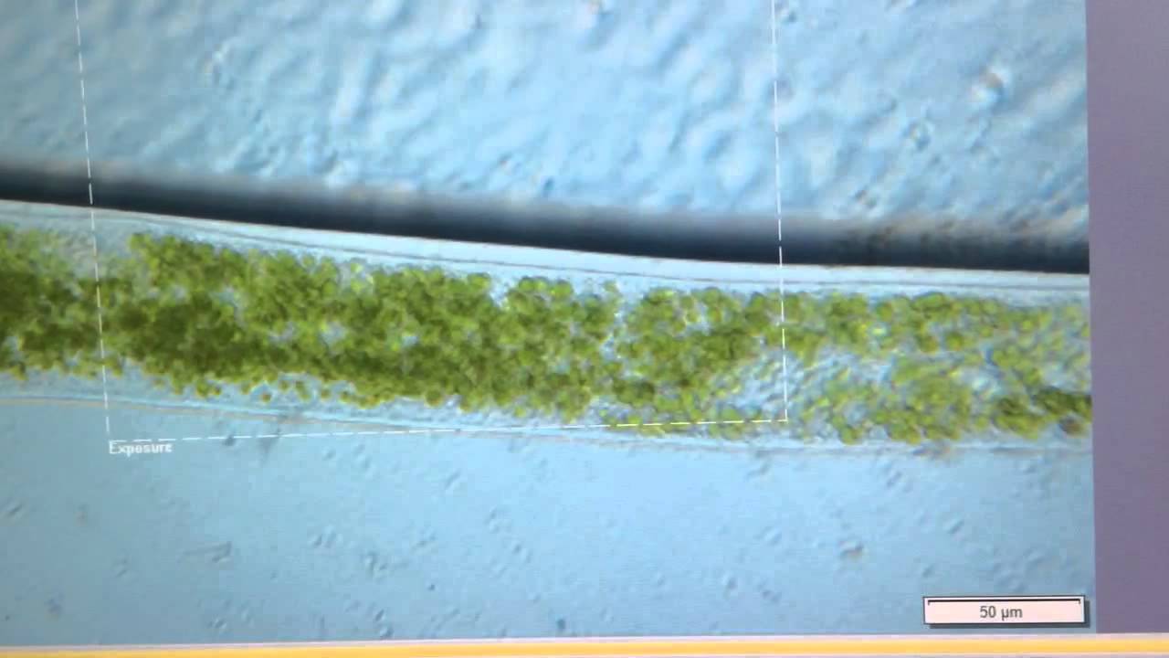 symbiotic chlorella algae in ciliate Spirostomum