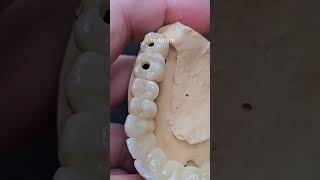 Anterior Coping Design | Dental Lab Work #dentist #zirconiajewellery