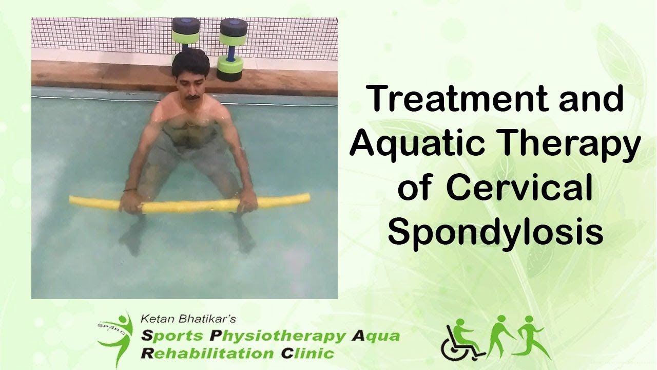 Treatment and Aquatic Therapy of Cervical Spondylosis