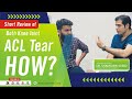 ACL surgery delayed or neglected now what happen?📢🔍🔬🌍🔍 what is main reason for both ACL tear????