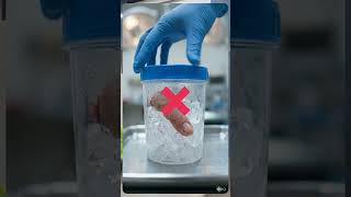 Amputated Part After Accident? This One Mistake Can Cost the Limb | Dr. Surekha Vellala