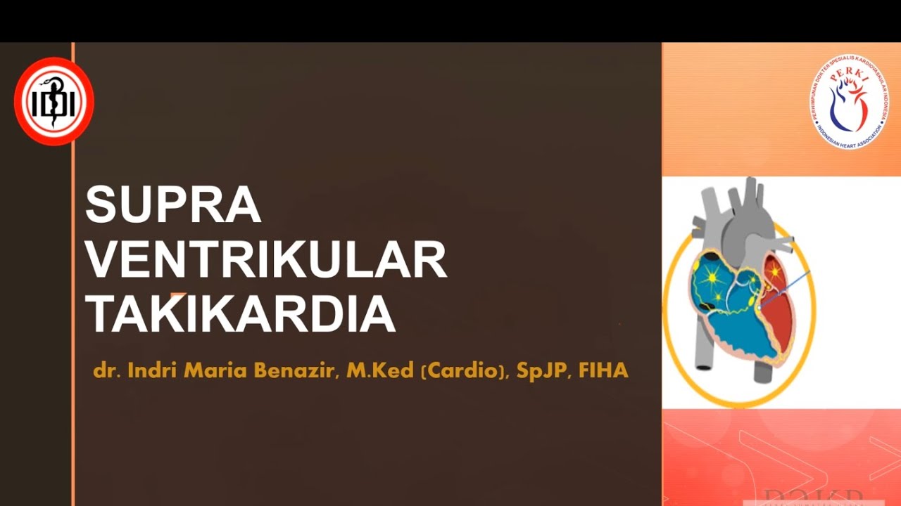 Cardioclass for GP : Supra Ventrikular Takikardia