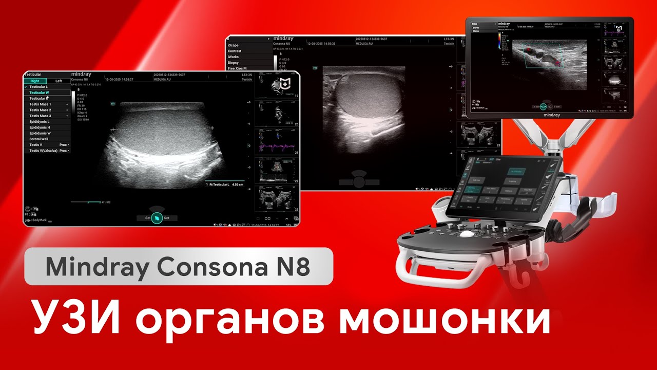 УЗИ мошонки: как работает Mindray Consona N8 в урологии?