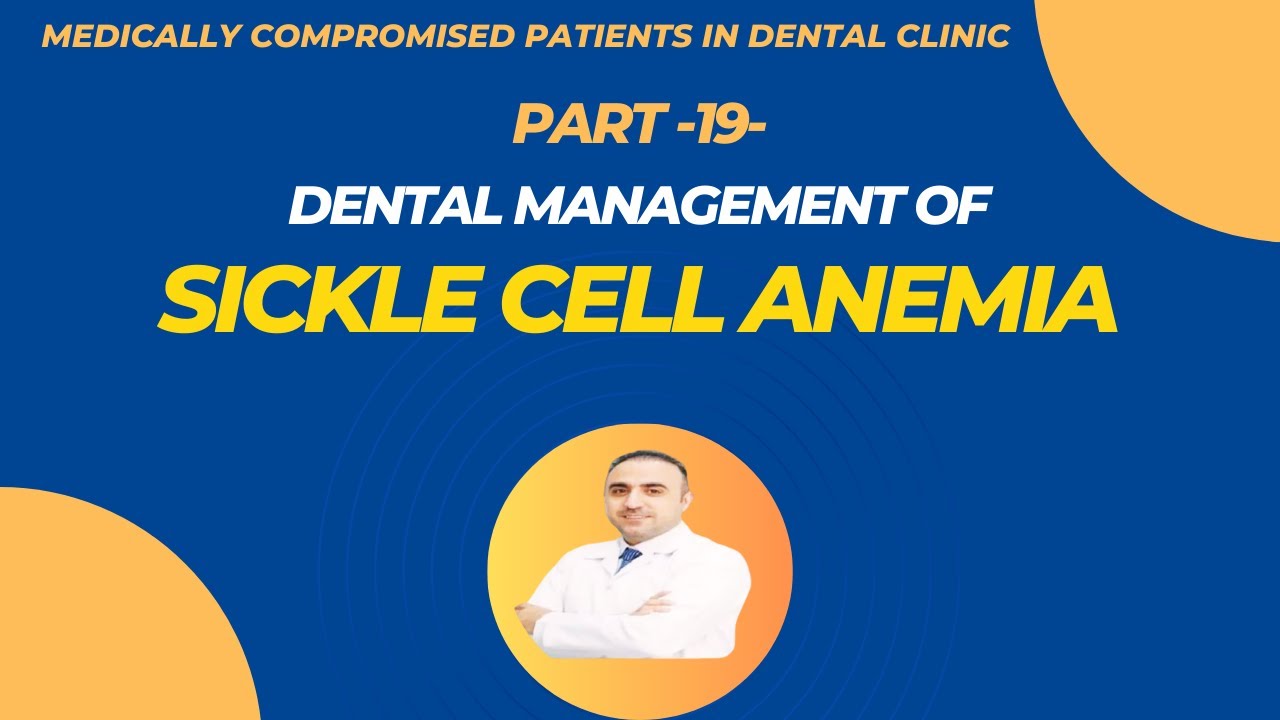 19- تدبير مرضى فقر الدم المنجلي في عيادة الأسنان - Dental Management of Sickle Cell Anemia