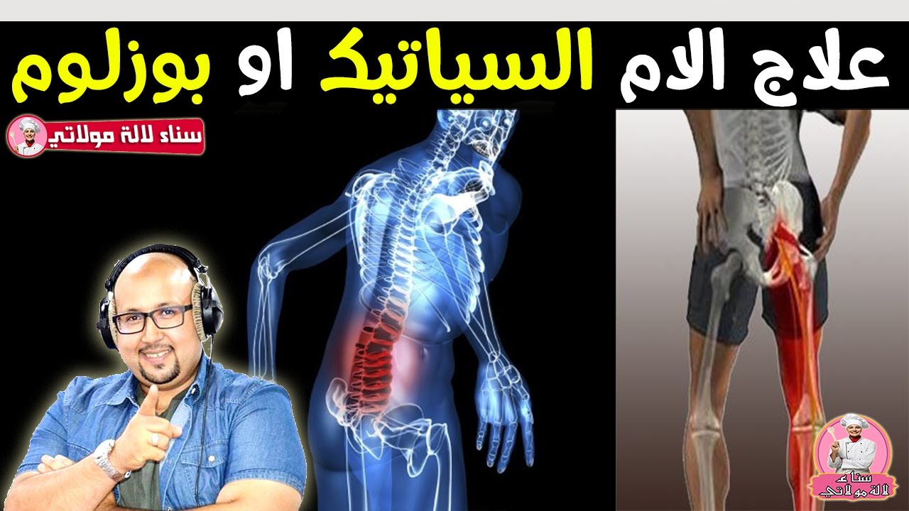 السياتيك او بوزلوم اعراضه وطرق العلاج بوصفات طبيعية مع المروض الطبي نبيل شيبوب والدكتور عماد ميزاب