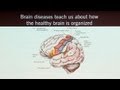 Brain Games that Capture Brain Circuits and What Neuroscience Tells Us about the Self