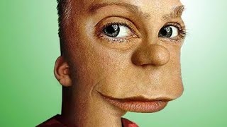 Dead Bart Extract Remake