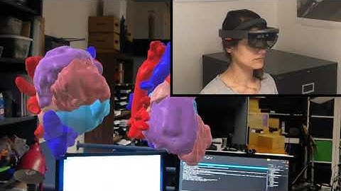 Manipulating 3D Anatomic Models in Augmented Reality