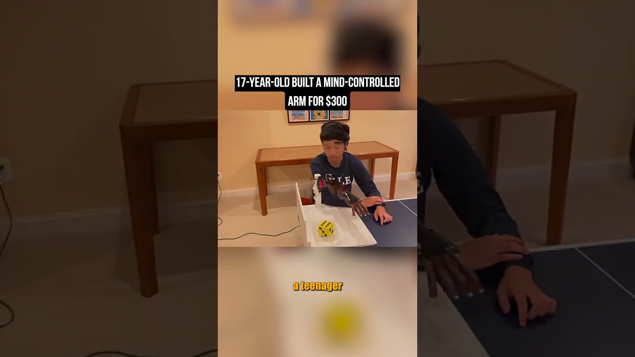 17 Year Old Built a Mind Controlled Arm for $300