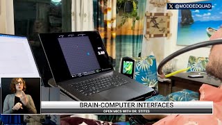 Open Mics with Dr. Stites - Nanotechnology Implants