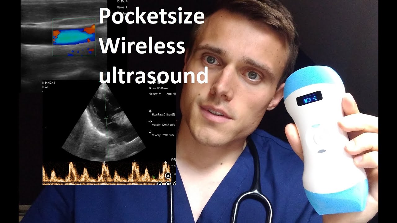 Pocketsize wireless ultrasound for doctor clinicians YouTube