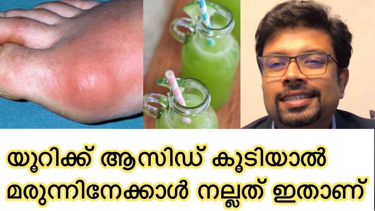 Uric acid കൂടിയാൽ മരുന്നിനേക്കാൾ നല്ലത് ഇതാണ് | Uric acid remedies