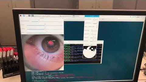 Video Ophthalmoscope RPi Prototype [LIVE Overlay]