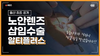 ★최초공개★ 노안렌즈삽입수술, "알티플러스" ㅣ 직원이 직접 수술 받았습니다!