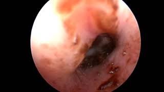 文永堂出版 - 犬と猫の耳の医学 補遺版：動画情報