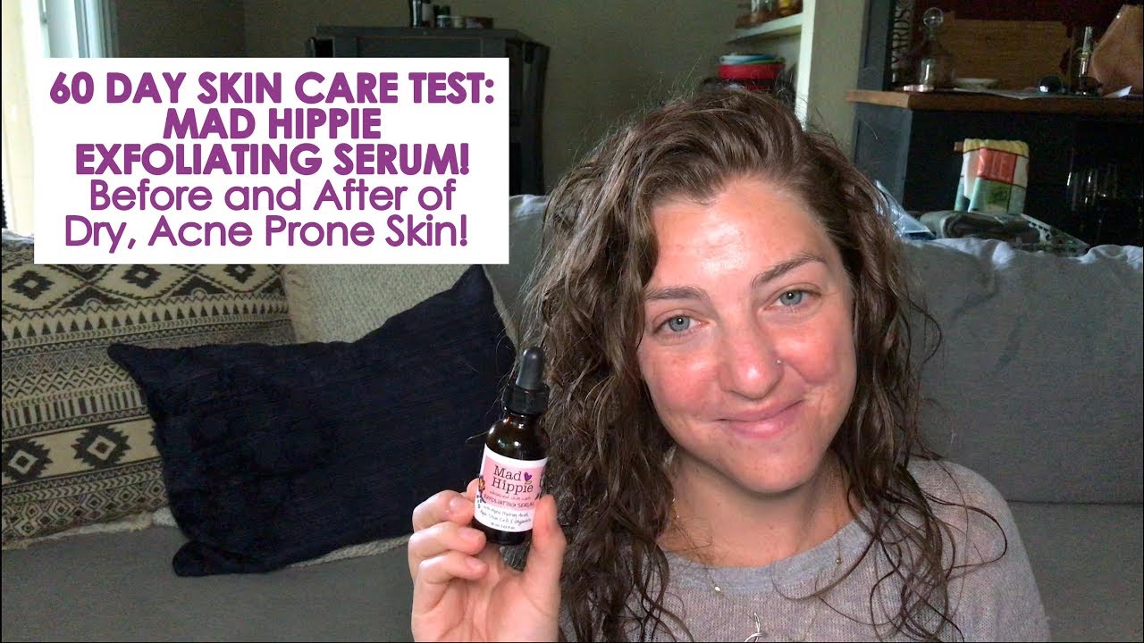 60 DAY SKIN CARE TEST MAD HIPPIE EXFOLIATING SERUM! Before and After