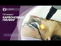 Процедура карбоновый пилинг