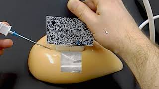 Augmented Reality Ultrasound on Hololens