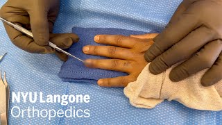 Excision of Glomus Tumor Using the Nail-sparing Approach | NYU Langone Ortho | Dr. Nader Paksima