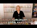 Gözaltı Morlukları İçin Evde Doğal Karışım