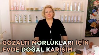 Suna Dumankaya | Göz Altı Şişlikleri İçin Evde Doğal Karışım - Güzellik & Bakım