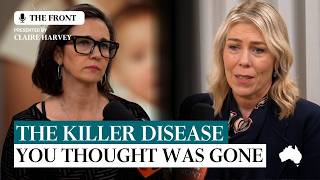 Diphtheria outbreak Australia: Why the killer disease Is back, and should you get vaccinated?