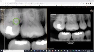 Training: Apteryx XVWeb - How to Compare Images in XVWeb 2.0
