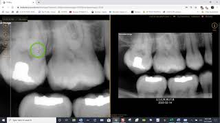 Training: Apteryx XVWeb - How to Compare Images in XVWeb 2.0