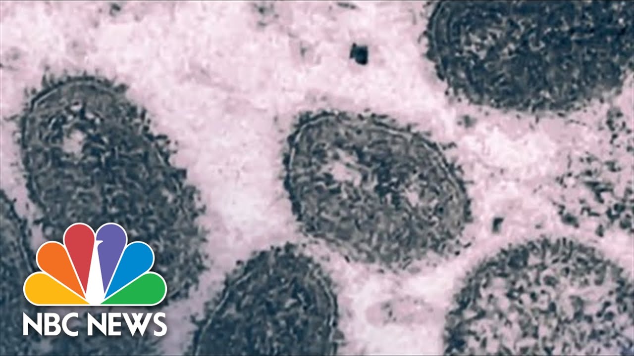 Manhattan Clinic Overwhelmed By Demand For Monkeypox Vaccines