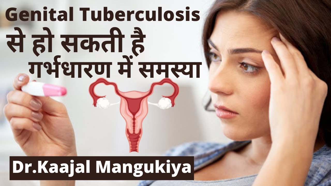 Genital Tuberculosis से हो सकती है गर्भधारण में समस्या  | Dr.Kaajal Mangukiya