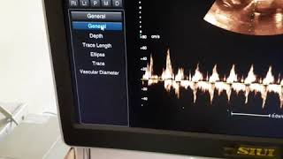 Ultrasonography -How to measures Fetal Heart Rate.