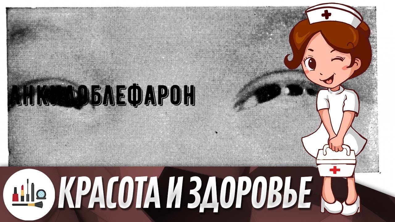 Анкилоблефарон