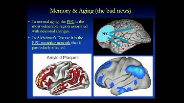 Human Memory, Aging and the Brain or Where Did I Put Those Keys?