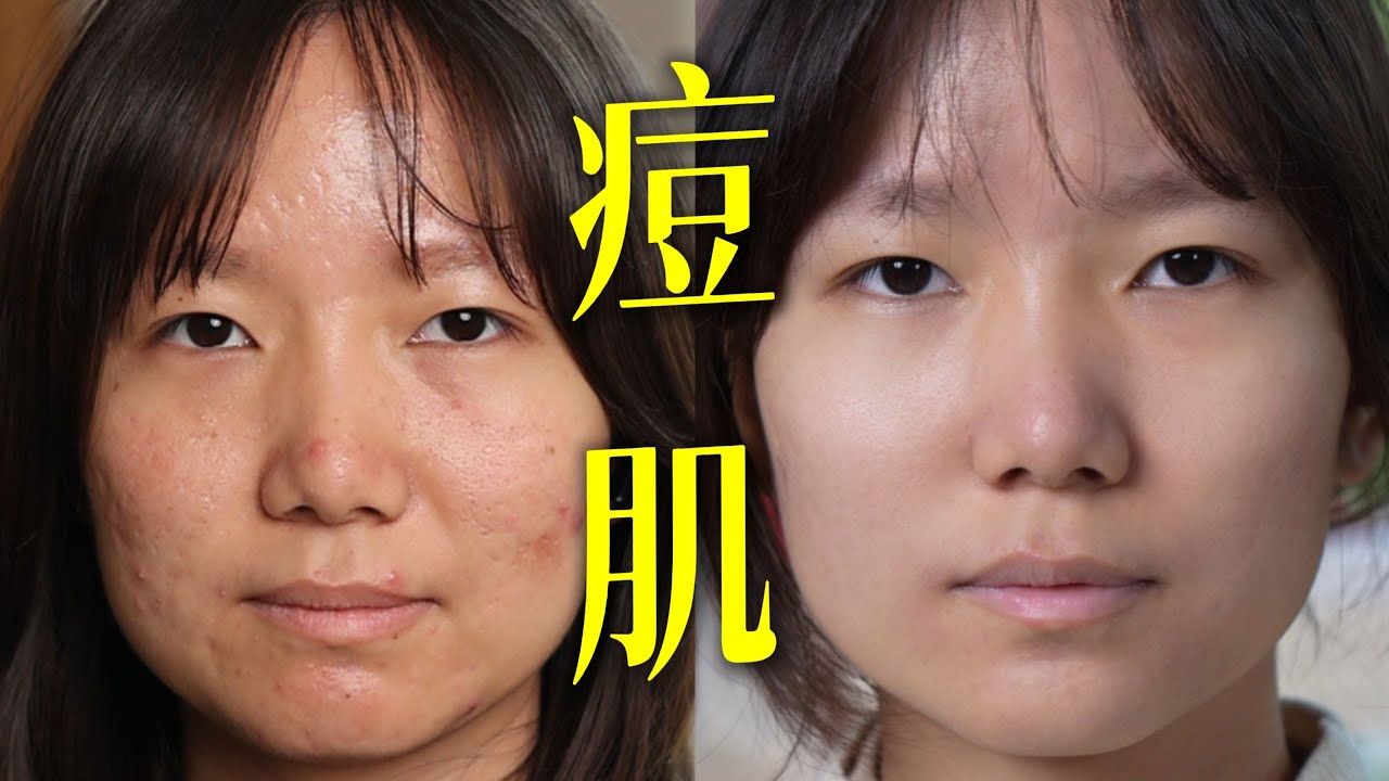 痘肌化妆第一步，先磨皮